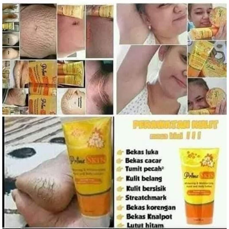 Prime skin heandbody lation pencerah kulit,penghilang bekas luka,pemutih ketiak dan selangkangan