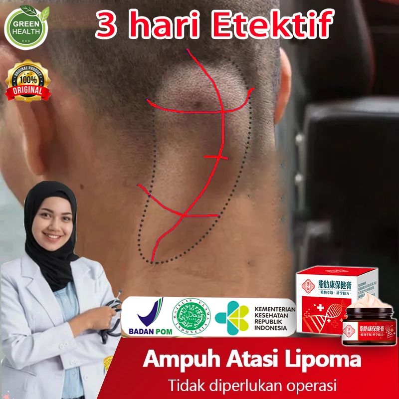 salep lipoma obat herbal benjolan lipoma removal cream original salep benjolan lipoma cream original
