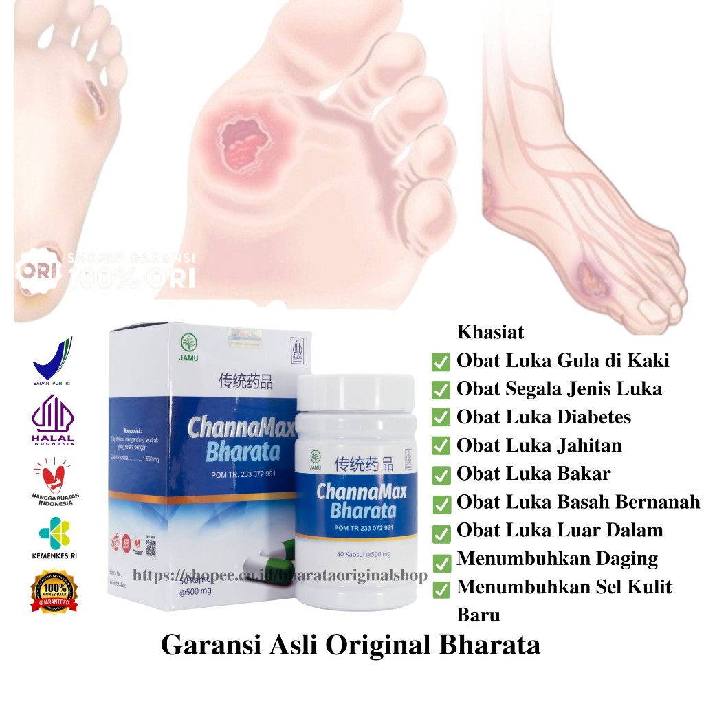 Obat Luka Diabetes Ampuh CHANNAMAX BHARATA Original Obat Luka Gula Pengering Luka Basah Bernanah