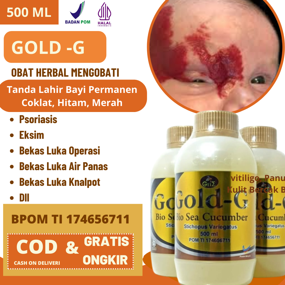 GOLD-G ASLI ORIGINAL - Penghilang Tanda Lahir Bayi Permanen Tanda Lahir Coklat, Hitam, Merah, Obat P