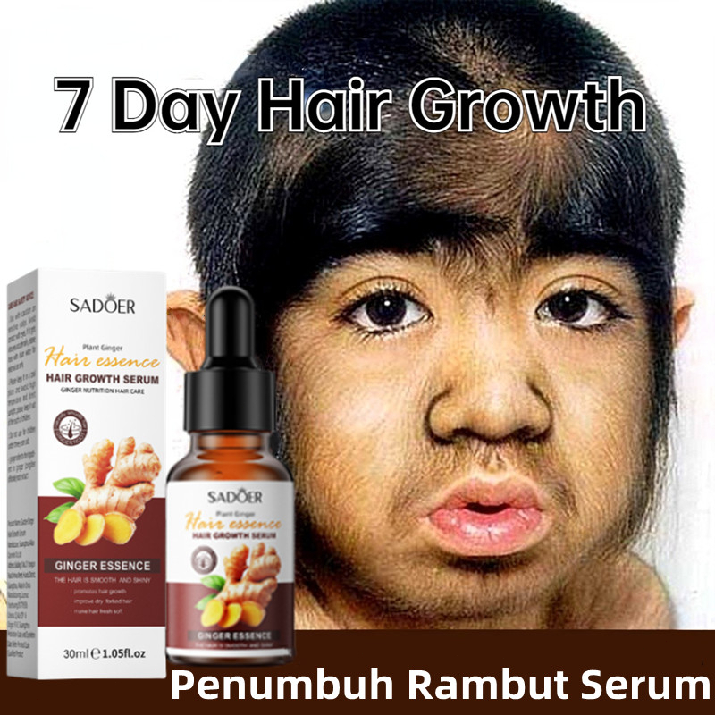 Penumbuh Rambut Serum Rambut Rontok Perawatan Rambut Hair Growth Serum Jahe Memperbaiki Tekstur Ramb