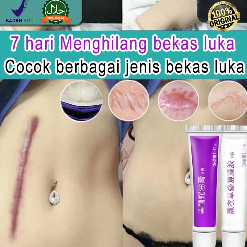 Gel Bekas Luka Krim Bekas Luka Penghapusan Bekas Luka Jerawat Membakar Stretch Mark Scab Krim Penghi