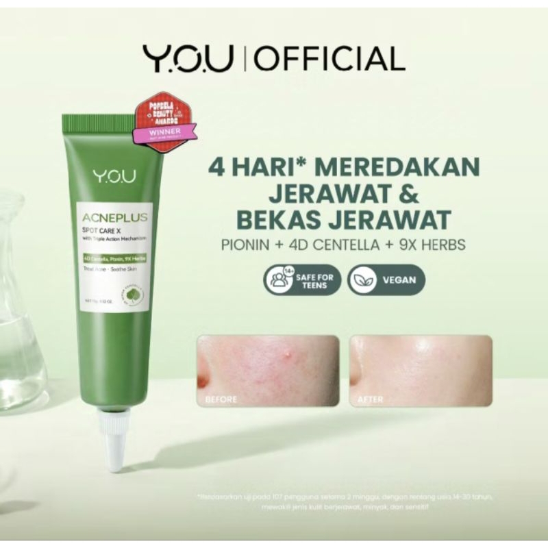 ( New Upgrade) YOU AcnePlus Triple Action Spot Care / obat jerawat you acne spot / you acne spot car