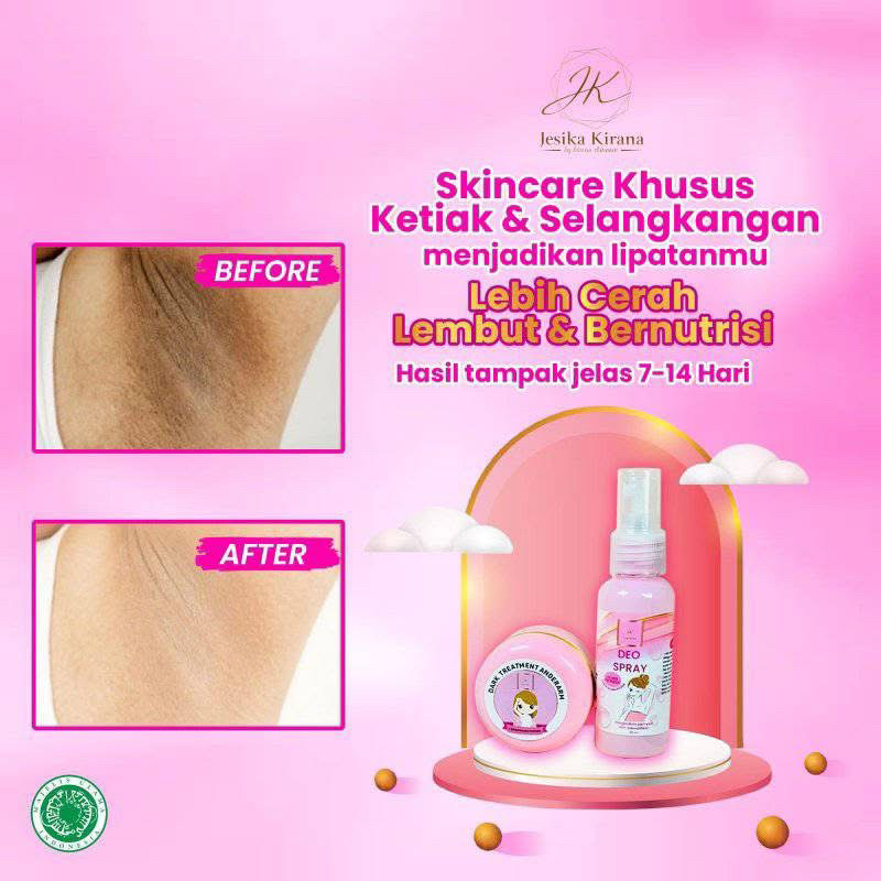 Pemutih ketiak / whitening / pencerah ketiak / cream pemutih ketiak / spary ketiak / whitening ketia