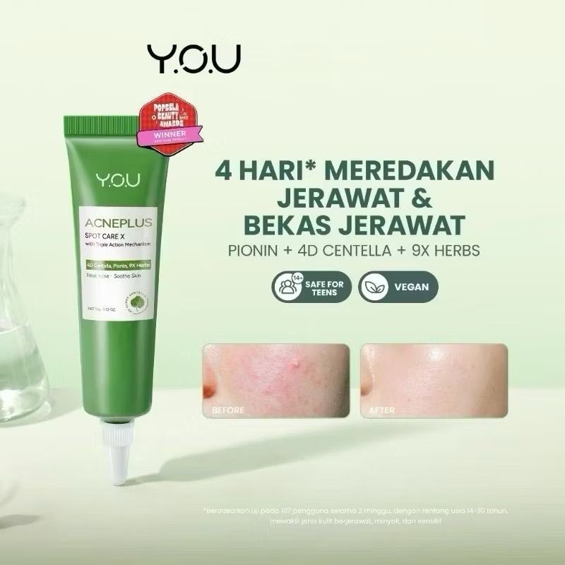 You Acne Plus Triple Spot Care | Obat Totol jerawat | Paket Jerawat You | Moisturizer Acne You | Ess
