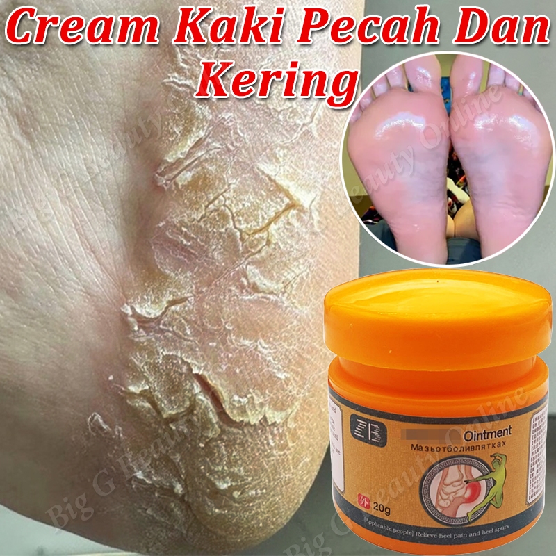 Cream Kaki Pecah Dan Kering Foot Cream Pelembab Kaki Kering Dan Pecah Cream Kaki Kering Dan Kasar Ob