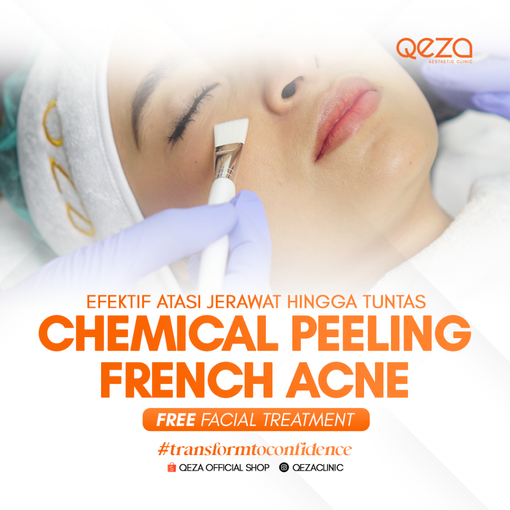 QEZA BEST SELLER TREATMENT : CHEMICAL PEELING FRENCH ACNE