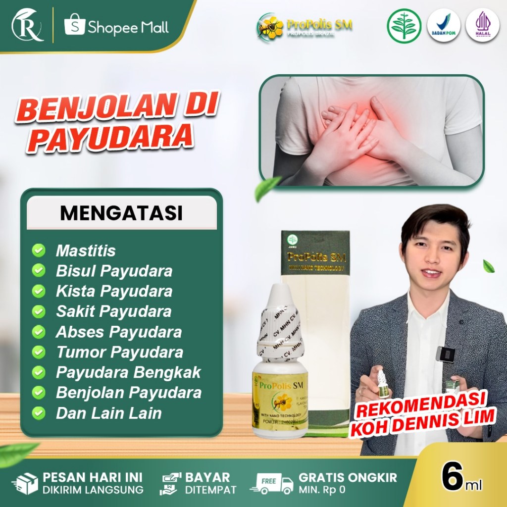 PROPOLIS SM Obat Benjolan Di Payudara Bisul Abses Payudara Bengkak Sakit Mastitis Fibroadenoma