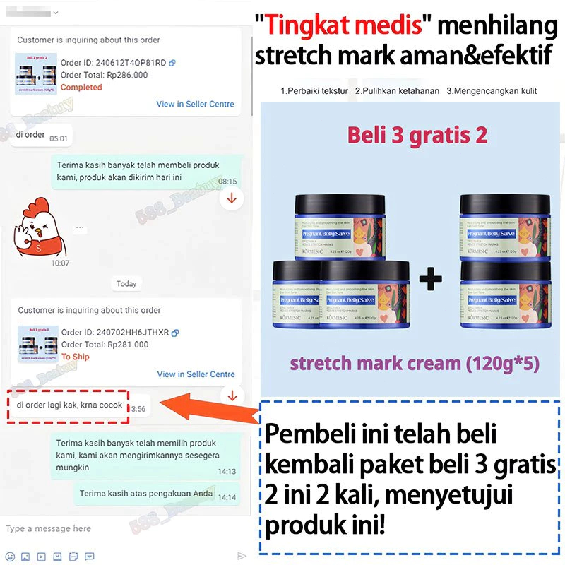 NT1 krim stretch mark Stretch mark cream Penghilang stretch mark 120g Krim Penghilang Strechmark