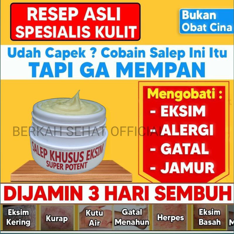 OBAT EKSIM BASAH EKSIM KERING EKSIM MENAHUN JAMUR KULIT JAMUR KULIT PALING AMPUH RACIKAN