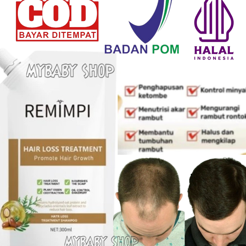 Shampo remimpi mengatasi rambut rontok bpom original 300ML