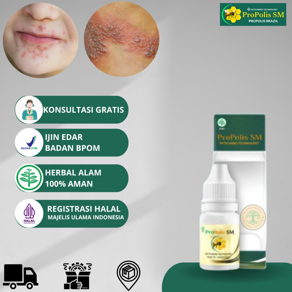Obat Herpes Kulit Gatal Berair Menyebar Eksim Kering Menahun Herpes Kelamin Bibir Miss V Herpes Geni