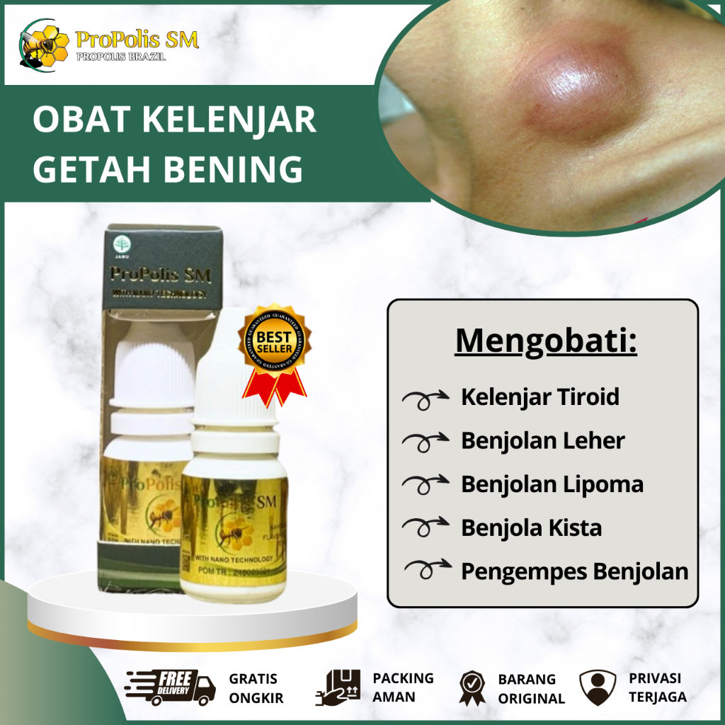 Obat Oles Pengempes Kelenjar Getah Bening Di Leher Ketiak Paha Bawah Rahang Dagu Belakang Telinga Ke
