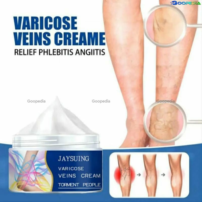 [ ORIGINAL 100% ] JAYSUING VARICOSE VEIN REPAIR CREAM | KRIM SALEP PENGHILANG VARISES URAT VENA KAKI