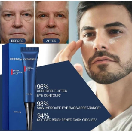 Openeyes Serum Gel Pengencang Mata Anti Penuaan Menghilangkan Kantong Mata