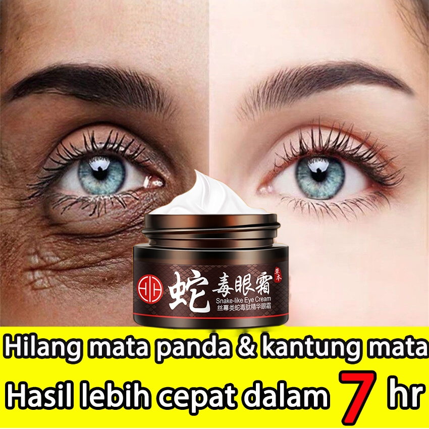 100% Asli / Krim Mata Anti Keriput Kantung mata Perawatan Kulit Anti-krim kantung mata ampuh-menghil