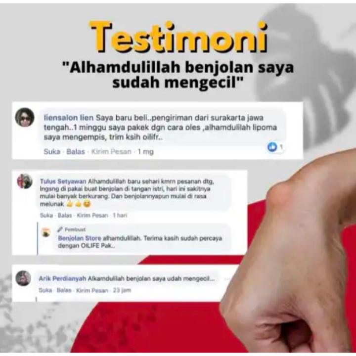 RB Oilife Minyak Oles Penghilang Benjolan Permanen Tanpa Operasi Seperti Tiroid Lipoma Ambeien