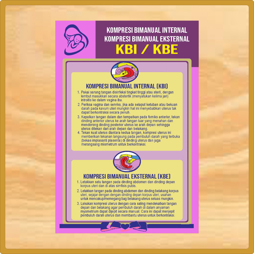 Stiker Poster Kompresi Bimanual Internal/Eksternal (KBI-KBE), Stiker Poster Kebidanan, Stiker Poster