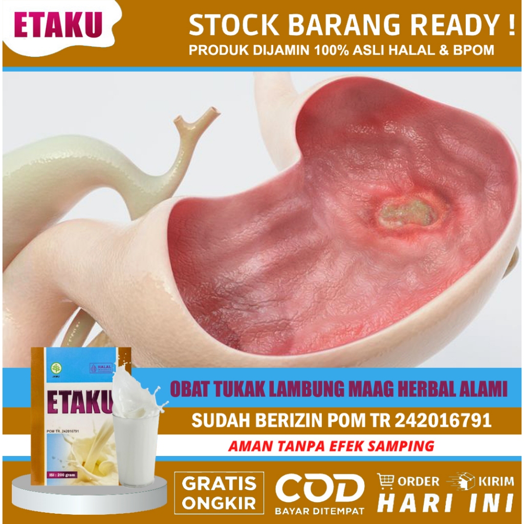 

Susu Untuk Kesehatan Jaga Lambung Sakit Maag Perut Kembung - ETAKU Susu Kambing Etawa Murni
