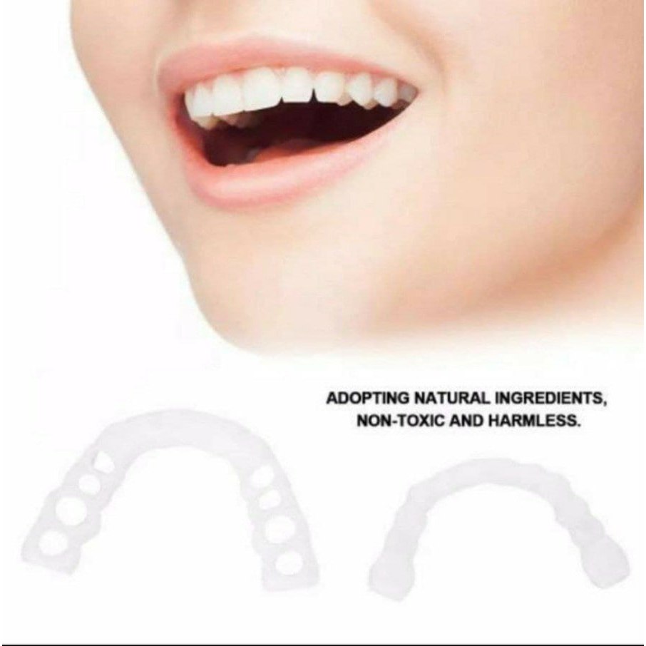 Veneer instan perapi gigi LNS