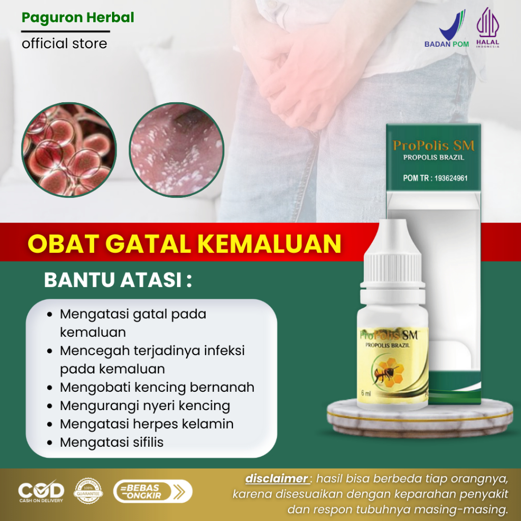 Obat Vagina Gatal Perih Lecet, Infeksi Jamur & Bakteri, Penghilang Gatal Pada Kemaluan - PROPOLIS SM