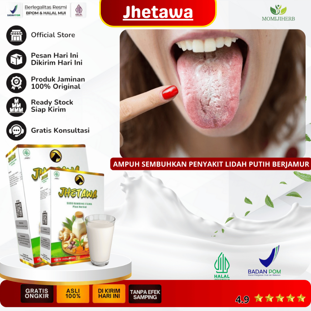 Obat Lidah Putih Berjamur, Obat Bercak Putih di Lidah, Kandidiasis Lidah, Lidah Dan Bibir Pecah Peca