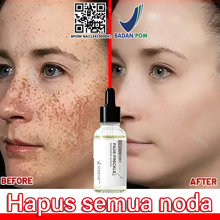serum flek hitam bpom serum flek hitam membandel penghilang flek hitam di wajah serum wajah glowing 