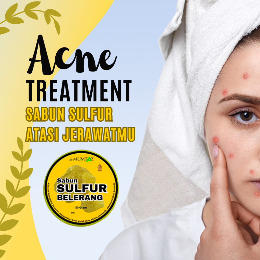 COD Sabun Sulfur Belerang untuk Gatal, Jerawat, Eksim, Scabies, Panu – Ampuh Atasi Iritasi Kulit, Re