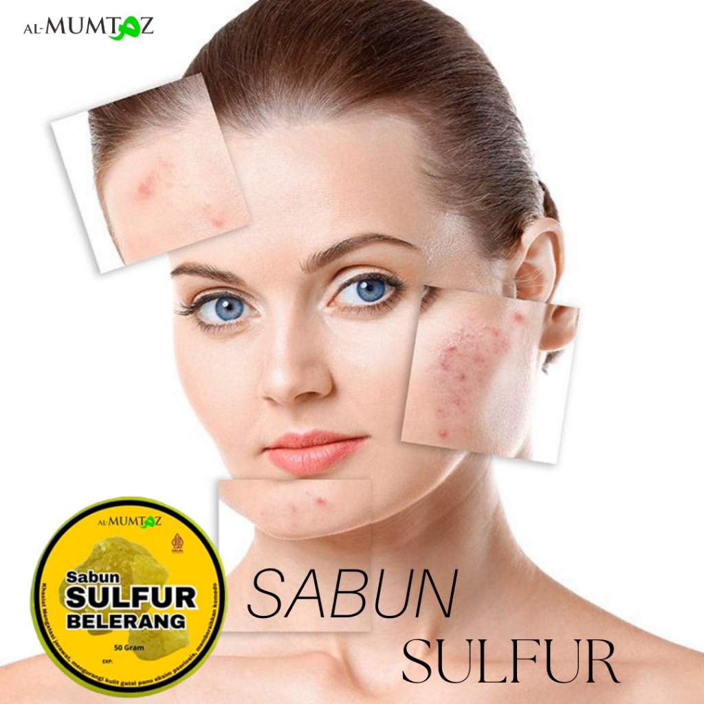 COD PROMO SABUN VIRAl Sabun Sulfur Belerang untuk Gatal, Jerawat, Eksim, Scabies, Panu – Ampuh Atasi