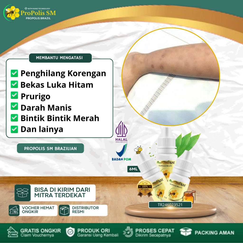 Obat Penghilang Bekas Koreng Di Badan, Korengan Di Kaki, Penghilang Bekas Luka Hitam, Penghilang Bek