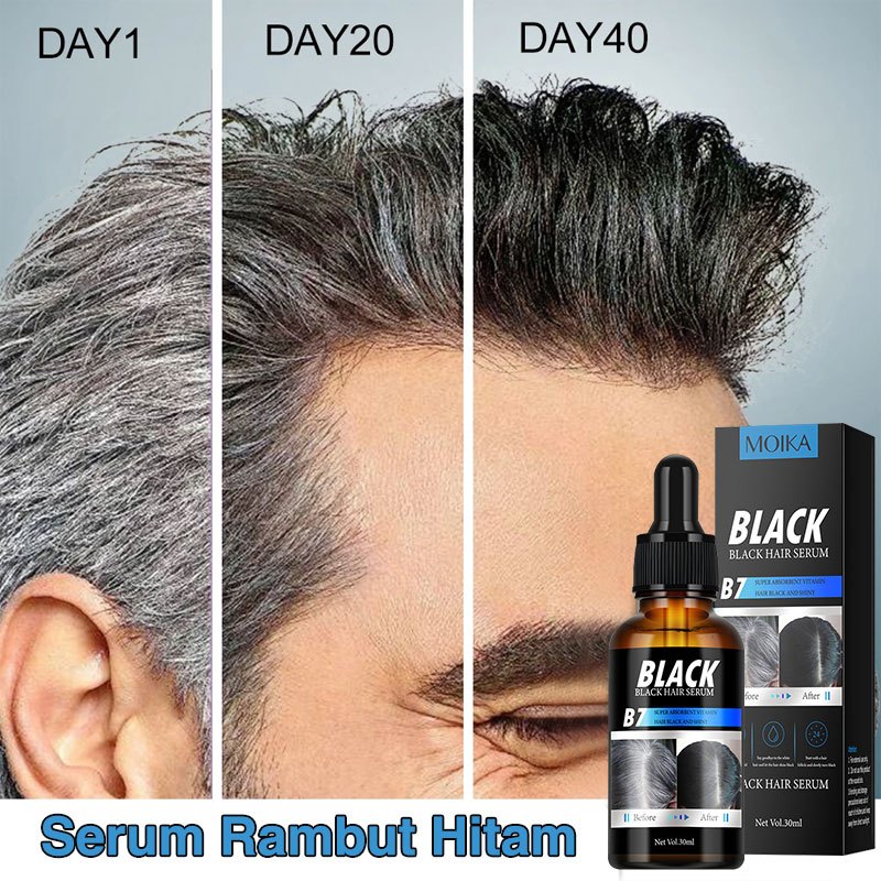 Serum rambut hitam 30ml Obat uban hilang permanen Penghitam rambut uban permanen Anti uban permanen