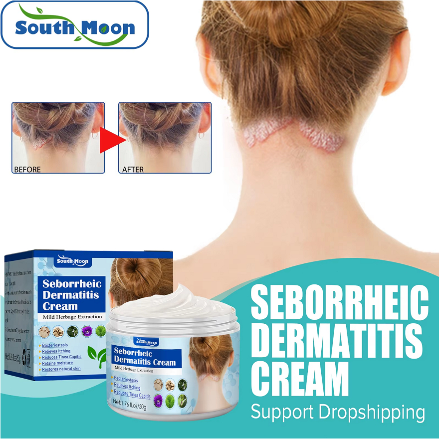 Seborrheic Dermatitis Cream 50g Psoriasis Dermatitis Seboroik Eczematoid Eczema Ointment Herbal Anti