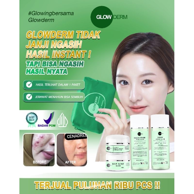 Paket Acne Glowderm