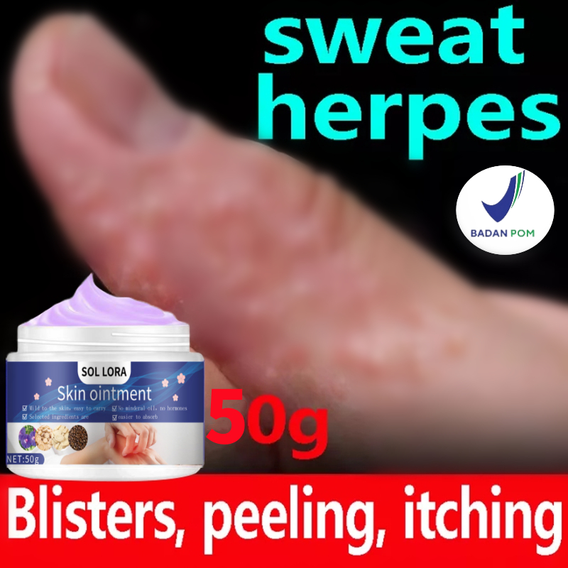50g salep gatal paling ampuh Obat Gatal Kulit salep eksim kering menahun salep psoriasis gatal kulit