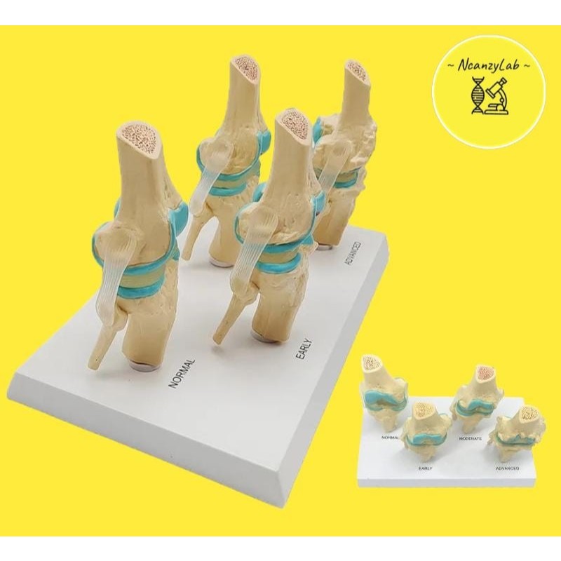 Alat Peraga Anatomi Manusia Model Kerangka Sendi Lutut Patologis