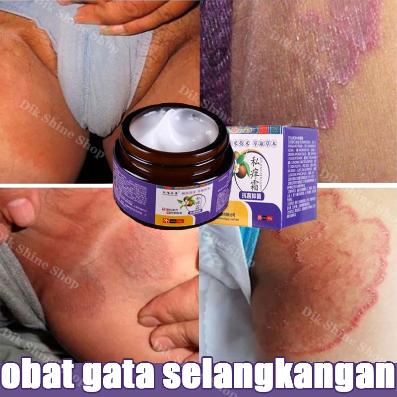 salep gatal selangkangan obat gatal salep anti jamur Eksim Psoriasis Obat gatal selangkangan obat ga