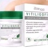 salep vitiligo cream bercak kulit keputihan cream vitiligo
