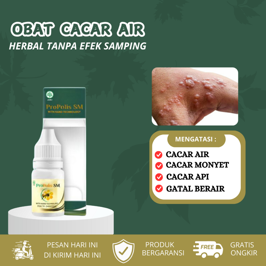 Obat Cacar, Bintik Bintik Merah, Cacar Air, Cacar Monyet Monkeypox, Cacar Api, gatal berair
