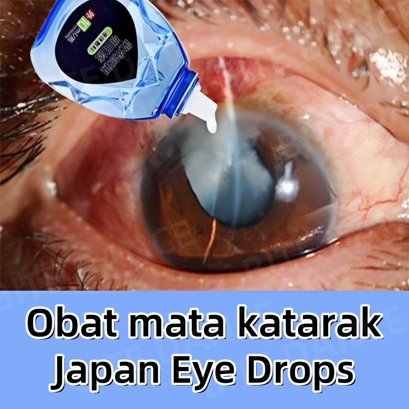 Tetes mata katarak obat mata merah tetes mata kering obat mata iritasi Pengobatan mata buram mata be