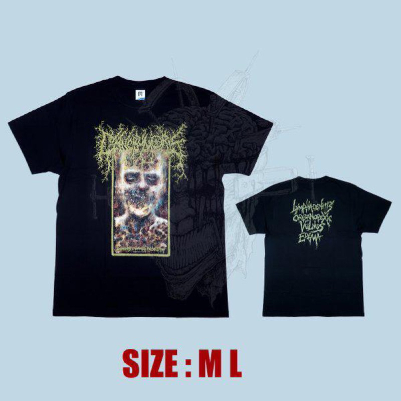 CANCRUM ORIS Lymphadenitis - TSHIRT ORIGINAL released By Pro guttural records