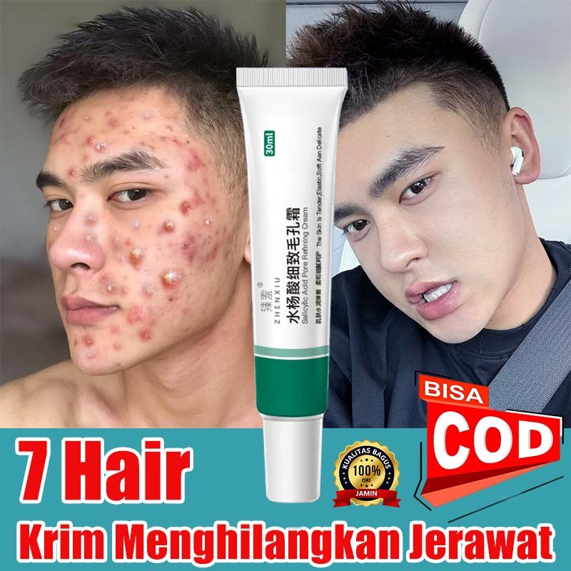 [COD]salep flek hitam yg asli/Salep Jerawat dan Bekas Jerawat Cream Anti Acne Cream 30g Krim Jerawat