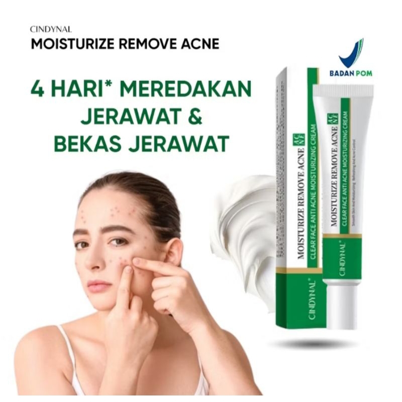 CINDYNAL SALEP OBAT JERAWAT DAN BEKAS JERAWAT