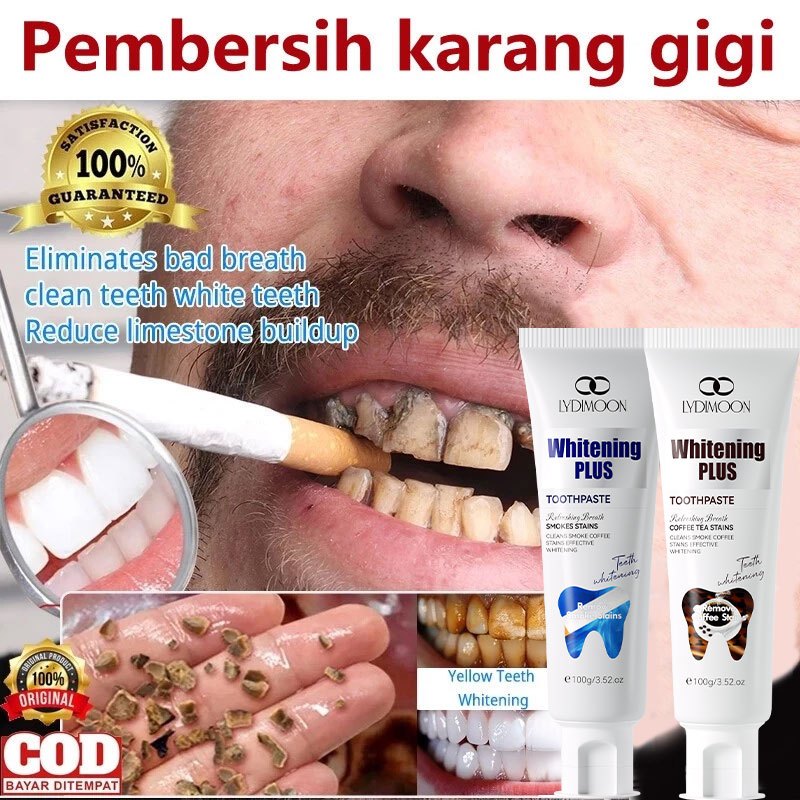 Perontok karang gigi Pasta gigi pemutih permanen100g Menghilang Noda Kopi&Teh /Pemutih Gigi Akibat M