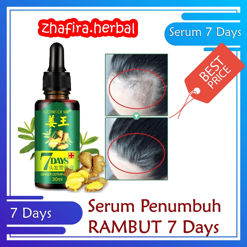 Serum 7 Days Ginger Germinal Oil - Serum Penumbuh Rambut Botak