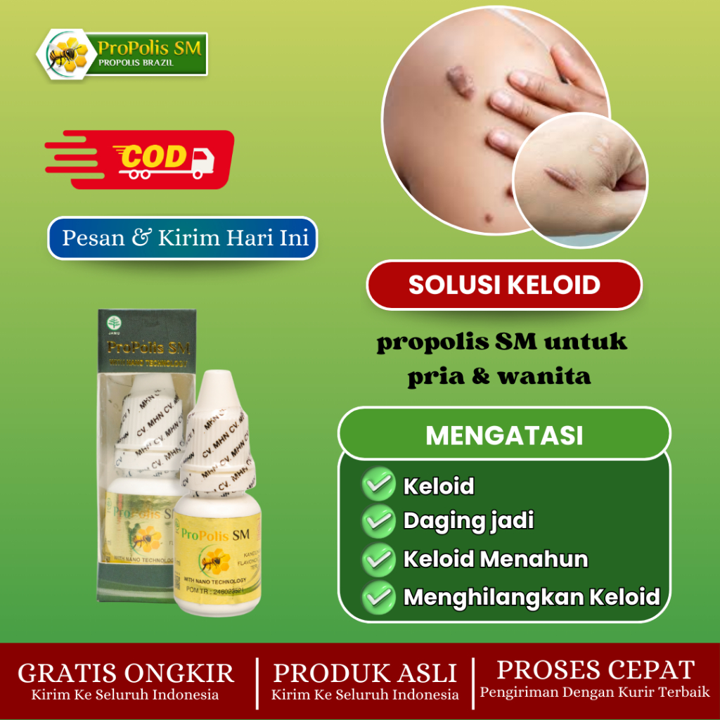 Propolis SM Obat Keloid, Obat Daging Tumbuh, Obat Keloid Menahun, Obat Penghilang Keloid Isi 6 ml