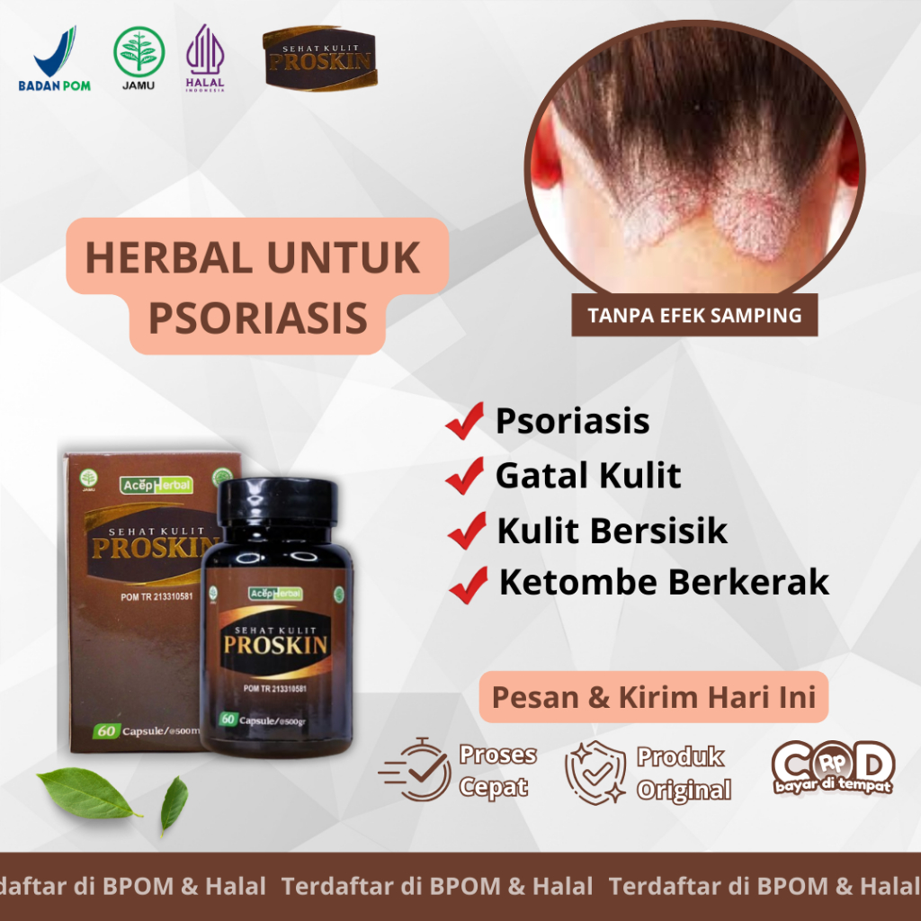 Proskin Sehat Kulit Obat Kulit Psoriasis, Kulit Bersisik, Kulit Kepala Bersisik