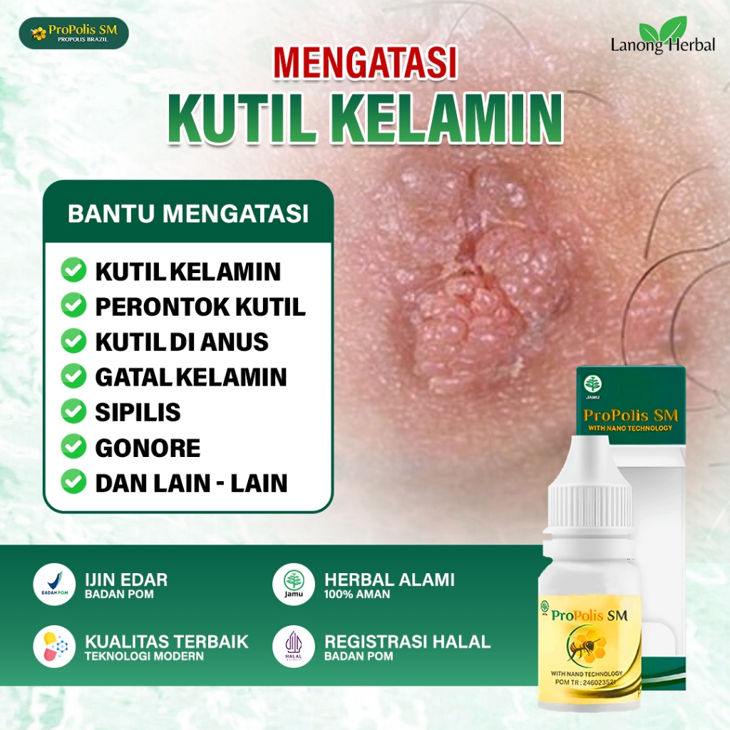 Jamu ProPolis SM Kutil Kelamin Obat Kutil Anus Pria / Wanita Penghilang Kutil Kelamin Alami