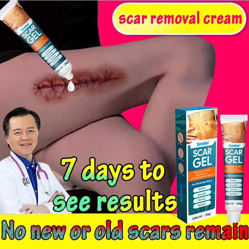 Obat penghilang bekas luka Salep penghilang bekas luka Penghilang bekas luka hitam 30g Cream Penghil