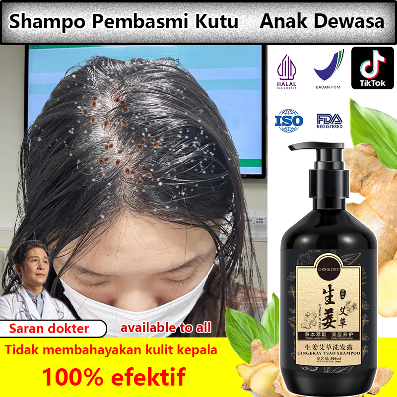 Sampo Kutu Rambut Paling ampuh untuk Anak&Dewasa 300ml / Sampo Anti Ketombe / Pembersih Kulit Kepala