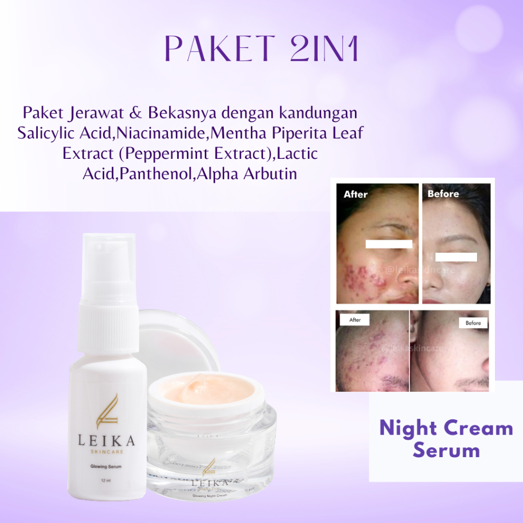 [NIGHT CREAM & SERUM] Penghilang Jerawat Dan Bekas Jerawat Bpom Penghilang Jerawat Dan Bruntusan Pen